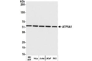 Western Blotting (WB) image for anti-ATP Synthase, H+ Transporting, Mitochondrial F1 Complex, alpha Subunit 1, Cardiac Muscle (ATP5A1) (AA 100-150) antibody (ABIN7453912)