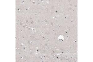 Immunohistochemical staining of human hippocampus with RBM28 polyclonal antibody  shows distinct nucleolar positivity in neuronal cells at 1:50-1:200 dilution. (RBM28 anticorps)