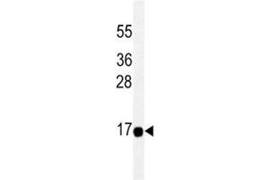 THEM2 antibody western blot analysis in HeLa lysate.