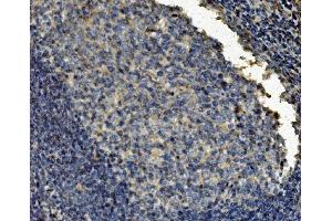 IHC analysis of Clathrin heavy chain/CLTC using anti-Clathrin heavy chain/CLTC antibody (ABIN7602703). (Clathrin Heavy Chain (CLTC) (AA 967-1668) anticorps)