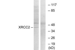 Western blot analysis of extracts from 293cells, using XRCC2 antibody. (XRCC2 anticorps  (C-Term))