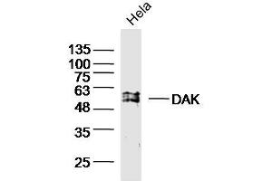HeLa cell lysates probed with DAK Polyclonal Antibody, unconjugated (bs-20314R) at 1:300 overnight at 4°C followed by a conjugated secondary antibody for 60 minutes at 37°C. (DAK anticorps  (AA 101-200))