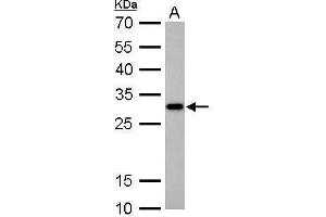 WB Image CTDSP2 antibody detects CTDSP2 protein by Western blot analysis.