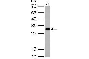 WB Image CTDSP2 antibody detects CTDSP2 protein by Western blot analysis. (CTDSP2 anticorps  (Center))
