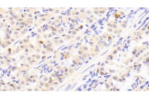 Detection of GT in Human Stomach Tissue using Polyclonal Antibody to Gastrin (GT) (Gastrin anticorps  (AA 1-101))