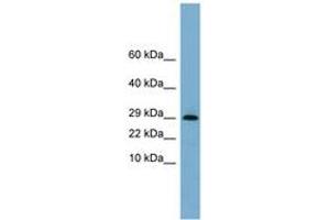 Image no. 1 for anti-Endoplasmic Reticulum Protein 29 (ERP29) (N-Term) antibody (ABIN6743333) (ERP29 anticorps  (N-Term))