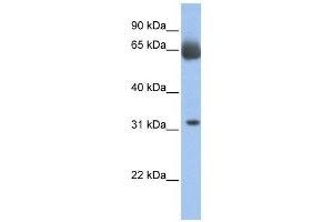 WB Suggested Anti-C11orf54 Antibody Titration:  0. (C11orf54 anticorps  (N-Term))