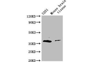 Western Blot Positive WB detected in: Mouse brain tissue All lanes: ADORA2B antibody at 3 μg/mL Secondary Goat polyclonal to rabbit IgG at 1/50000 dilution Predicted band size: 37 kDa Observed band size: 37 kDa (Adenosine A2b Receptor anticorps  (AA 292-332))