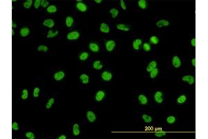 Immunofluorescence of monoclonal antibody to GATA2 on HeLa cell.