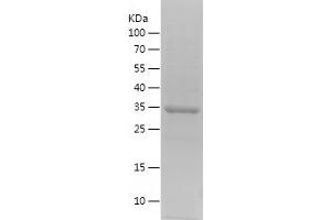 Western Blotting (WB) image for Elongation Factor RNA Polymerase II (ELL) (AA 308-560) protein (His tag) (ABIN7122762)