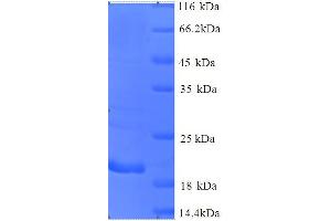 SDS-PAGE (SDS) image for Cancer/testis Antigen 1B (CTAG1B) (AA 1-180), (full length) protein (His tag) (ABIN5713382)