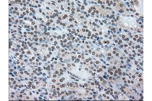 Image no. 5 for anti-Sjogren Syndrome Antigen B (SSB) antibody (ABIN1501146)