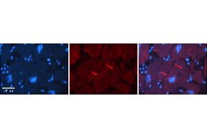Rabbit Anti-GABRR2 Antibody    Formalin Fixed Paraffin Embedded Tissue: Human Adult heart  Observed Staining: Membrane(tight junctions - intercalated disks) Primary Antibody Concentration: 1:600 Secondary Antibody: Donkey anti-Rabbit-Cy2/3 Secondary Antibody Concentration: 1:200 Magnification: 20X Exposure Time: 0.