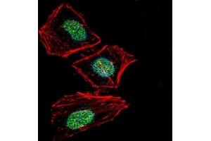 Fluorescent confocal image of HeLa cells stained with XRCC6 antibody.