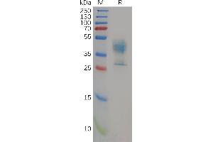 Human MDR-1 Protein, hFc Tag on SDS-PAGE under reducing condition.