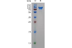 Mouse CD93 Protein, His Tag on SDS-PAGE under reducing condition.