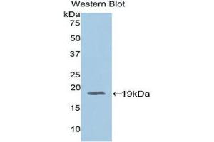 Western Blotting (WB) image for anti-Adrenomedullin (ADM) (AA 24-171) antibody (ABIN1857923) (Adrenomedullin anticorps  (AA 24-171))
