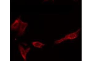 ABIN6266589 staining HepG2 by IF/ICC. (MMP1 anticorps  (C-Term))