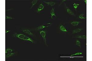 Immunofluorescence of purified MaxPab antibody to IMPDH2 on HeLa cell. (IMPDH2 anticorps  (AA 1-514))