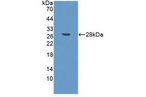 Detection of Recombinant FAPa, Mouse using Polyclonal Antibody to Fibroblast Activation Protein Alpha (FAPa)