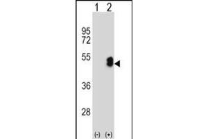 Western blot analysis of LMX1B (arrow) using rabbit polyclonal LMX1B Antibody (Center) (ABIN652882 and ABIN2842570).
