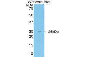 Western Blotting (WB) image for anti-Procollagen III N-Terminal Propeptide (PIIINP) (AA 34-272) antibody (Biotin) (ABIN1173224) (PIIINP anticorps  (AA 34-272) (Biotin))