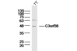 Human TT lysates probed with C3orf58 Polyclonal Antibody, Unconjugated  at 1:300 dilution and 4˚C overnight incubation. (C3orf58 anticorps  (AA 351-430))