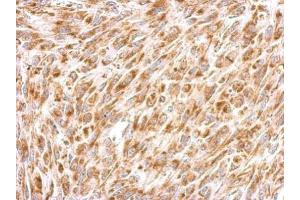 anti-Prohibitin 2 (PHB2) antibody