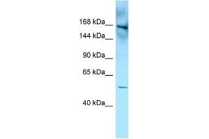 WB Suggested Anti-FYCO1 Antibody Titration: 1. (FYCO1 anticorps  (N-Term))