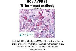 Image no. 1 for anti-Arginine Vasopressin Receptor 1B (AVPR1B) (Extracellular Domain), (N-Term) antibody (ABIN1732152) (AVPR1B anticorps  (Extracellular Domain, N-Term))