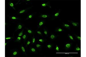 Immunofluorescence of monoclonal antibody to RPS2 on HeLa cell. (RPS2 anticorps  (AA 47-170))