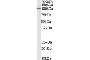 anti-La Ribonucleoprotein Domain Family, Member 1B (LARP1B) (Internal Region) antibody