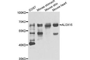 Western blot analysis of extracts of various cell lines, using ALOX15 antibody. (ALOX15 anticorps)