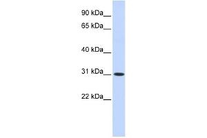 WB Suggested Anti-CYB5D2 Antibody Titration: 0. (CYB5D2 anticorps  (N-Term))