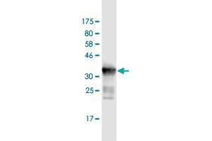 Western Blot detection against Immunogen (36. (DDX41 anticorps  (AA 523-622))