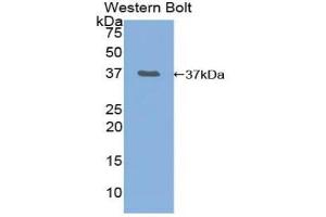 Detection of Recombinant NF2, Mouse using Polyclonal Antibody to Neurofibromin 2 (NF2) (Merlin anticorps  (AA 30-311))
