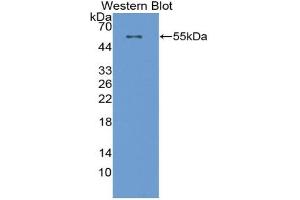 Western blot analysis of the recombinant protein. (CPT1A anticorps  (AA 572-773))