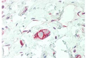 Rabbit Anti-SLC38A3 antibody  Formalin Fixed Paraffin Embedded Tissue: Human Colon, Submucosal Plexus Primary antibody Concentration: 1:100 Secondary Antibody: Donkey anti-Rabbit-Cy3 Secondary Antibody Concentration: 1:200 Magnification: 20x Exposure Time: 0.