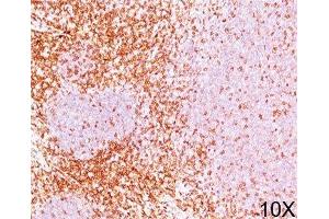 IHC testing of human tonsil stained with CD6 antibody (3F7B5). (CD6 anticorps)