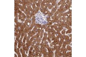 Immunohistochemical staining of human liver with PPP4R4 polyclonal antibody  shows strong cytoplasmic positivity in hepatocytes at 1:200-1:500 dilution. (PPP4R4 anticorps)