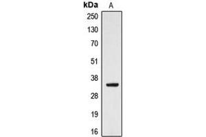 Western blot analysis of CYB5R3 expression in HeLa (A) whole cell lysates.