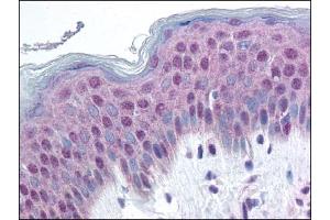 Image no. 1 for anti-High Mobility Group Nucleosome Binding Domain 1 (HMGN1) (AA 19-28), (pSer20), (pSer24) antibody (ABIN303233)