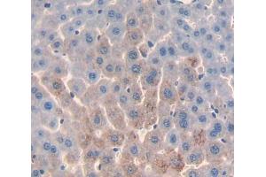Used in DAB staining on fromalin fixed paraffin- embedded Kidney tissue