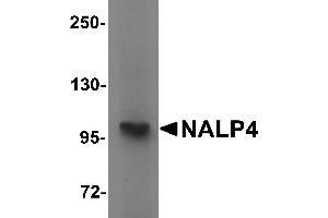 Western blot analysis of NALP4 in K562 cell lysate with NALP4 antibody at 1 µg/mL. (NLRP4 anticorps  (Middle Region))