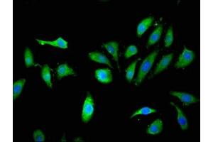 Immunofluorescent analysis of Hela cells using ABIN7157273 at dilution of 1:100 and Alexa Fluor 488-congugated AffiniPure Goat Anti-Rabbit IgG(H+L)