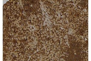 ABIN6277531 at 1/100 staining Rat spleen tissue by IHC-P.