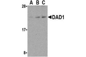 Western blot analysis of DAD1 in HepG2 cell lysate with AP30271PU-N DAD1 antibody at (A) 0. (DAD1 anticorps)