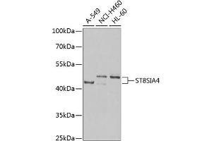 Western blot analysis of extracts of various cell lines, using ST8SI Antibody (ABIN6132840, ABIN6148545, ABIN6148546 and ABIN6222487) at 1:1000 dilution. (ST8SIA4 anticorps  (AA 20-168))