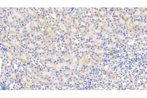 Detection of MCP1 in Mouse Kidney Tissue using Polyclonal Antibody to Monocyte Chemotactic Protein 1 (MCP1)