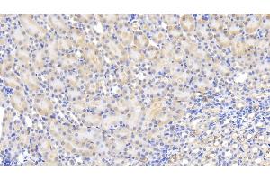 Detection of MCP1 in Mouse Kidney Tissue using Polyclonal Antibody to Monocyte Chemotactic Protein 1 (MCP1) (CCL2 anticorps  (AA 24-96))
